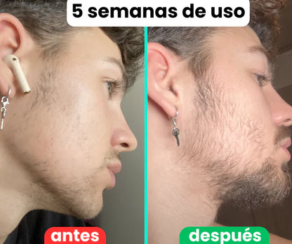 Bálsamo para Crecimiento de Barba Ultra Potente con Minoxidil 20% |