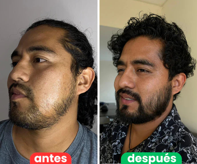 Bálsamo para Crecimiento de Barba Ultra Potente con Minoxidil 20% |